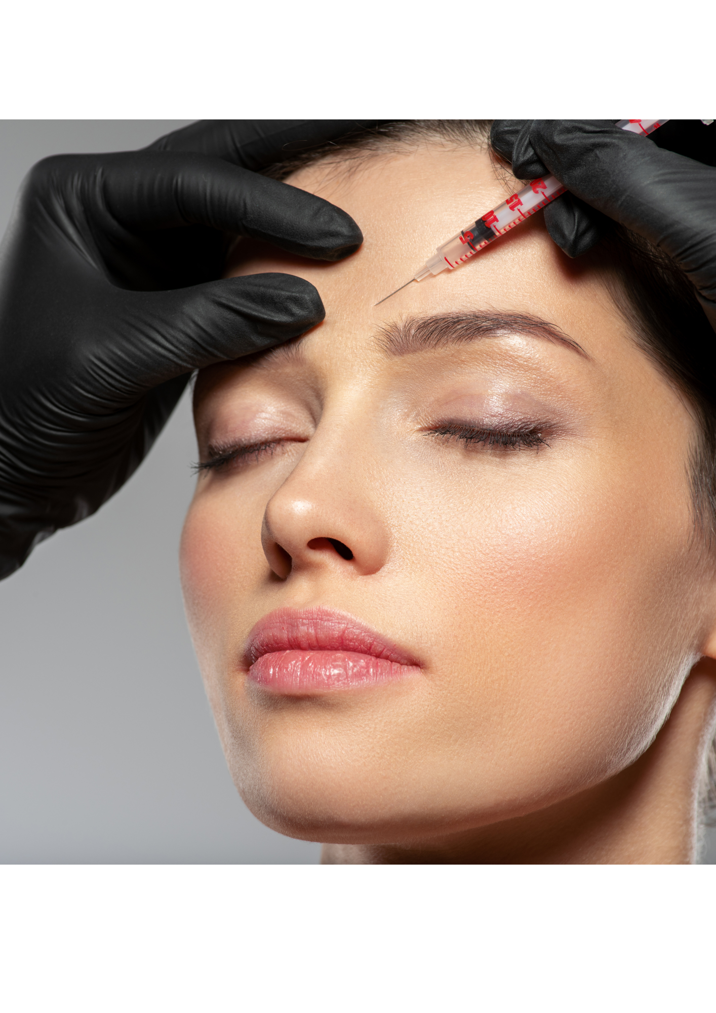 Aplicação de botox no rosto de uma mulher